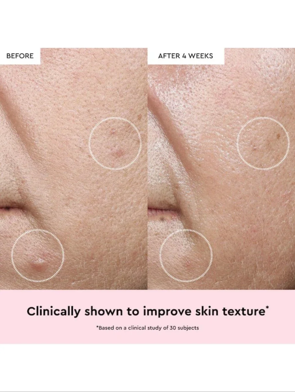 Glow Recipe Watermelon Glow Niacinamide Dew Drops Serum